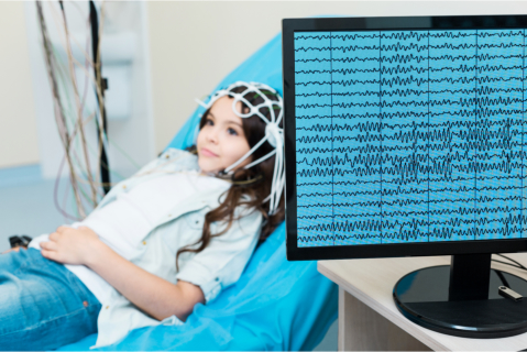 Focal Seizure What You Need to Know